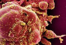 Mezcla hidroxicloroquina-zinc sería efectiva en pacientes con COVID-19, según estudio